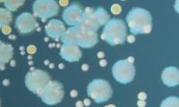 Revista PRODUCCION: Cómo enfrentar a la nueva generación de "supermicrobios"